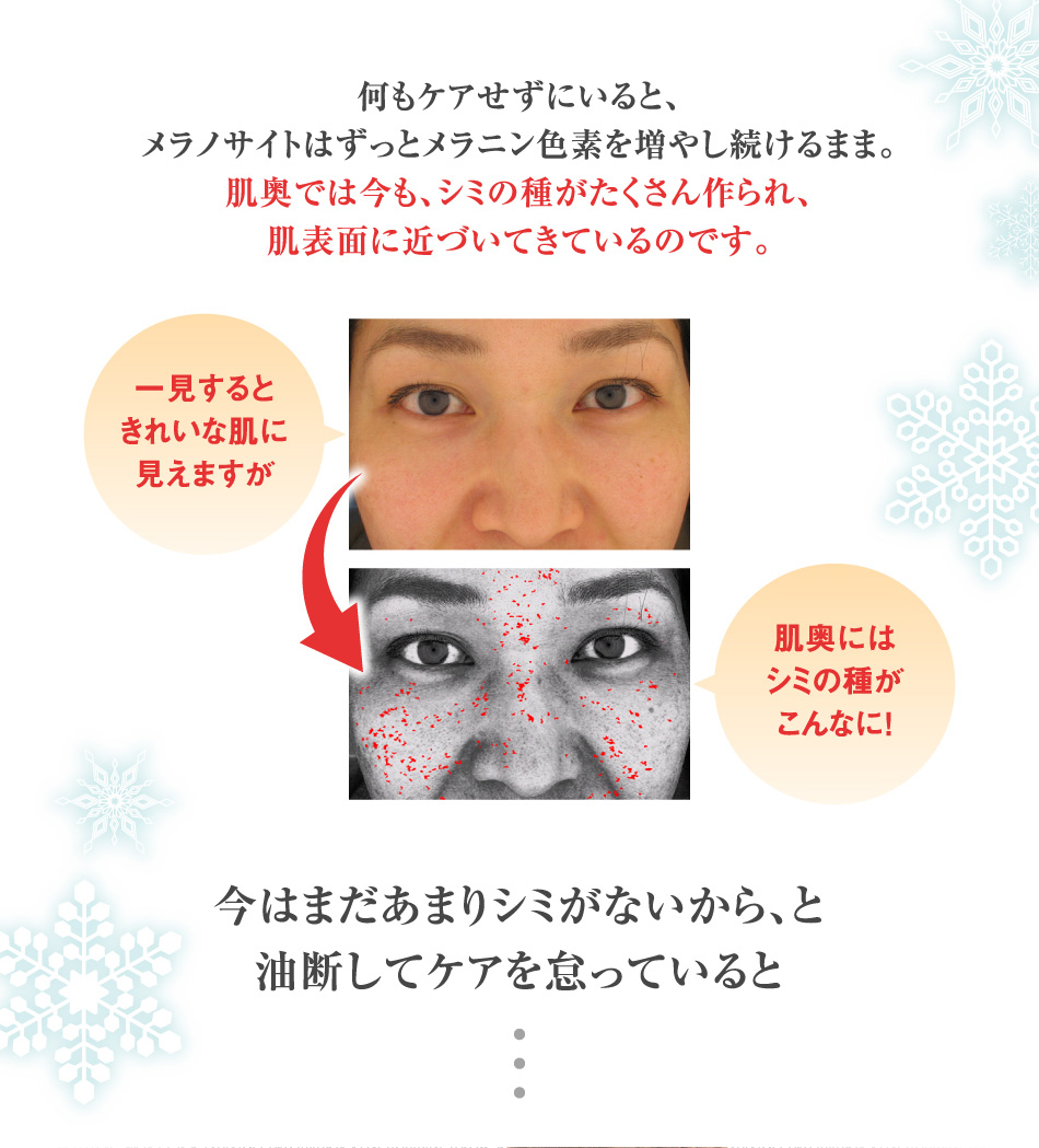 何もケアせずにいると、メラノサイトはずっとメラニン色素を増やし続けるまま。肌奥では今も、シミの種がたくさん作られ、肌表面に近づいてきているのです。今はまだあまりシミがないから、と油断してケアを怠っていると
